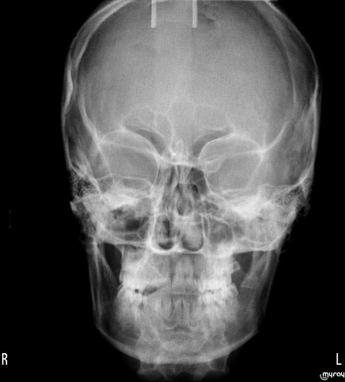 Ортодонтия. Переднезадняя телерентгенография – оценка для цефалометрического исследования.